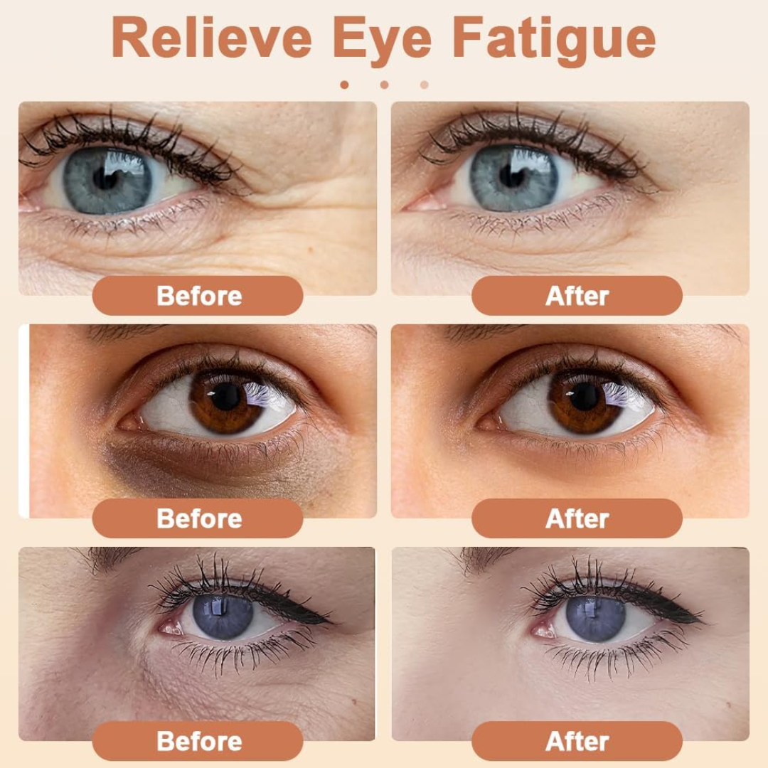Bulivia EyeLift™