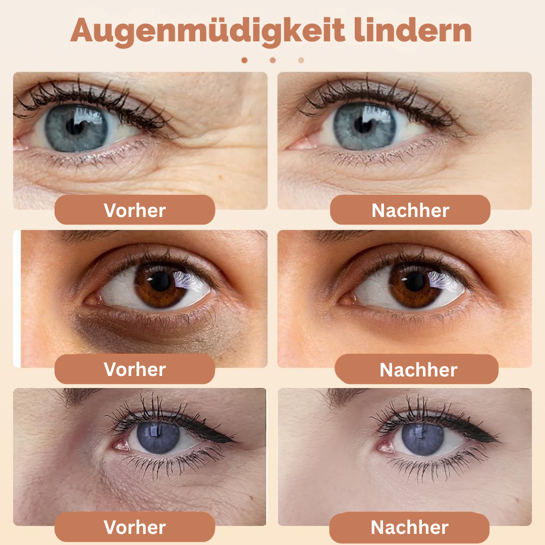 Bulivia EyeLift™